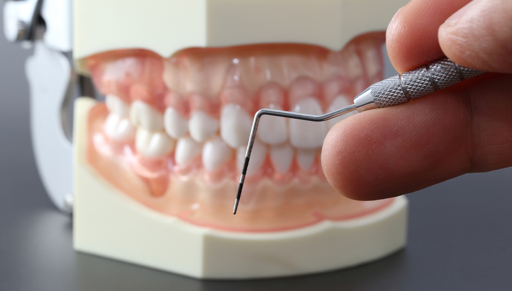 浜松市中区の歯周外科治療