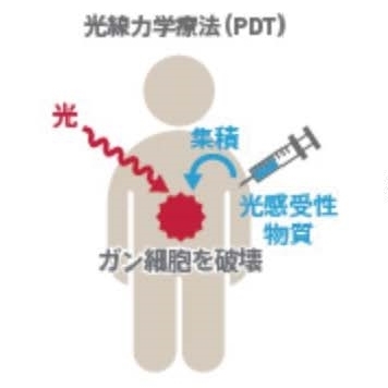 浜松市中区のレーザーを使った歯周病治療