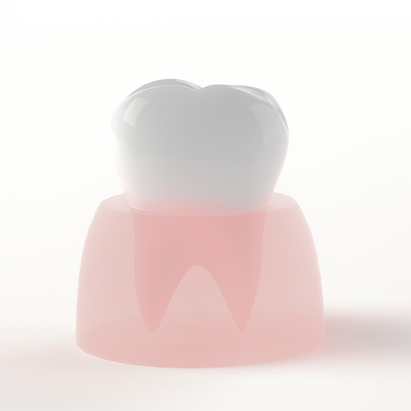 浜松市中区の歯周外科治療