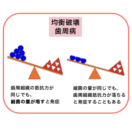 浜松市中区の歯周病・歯槽膿漏の原因菌について