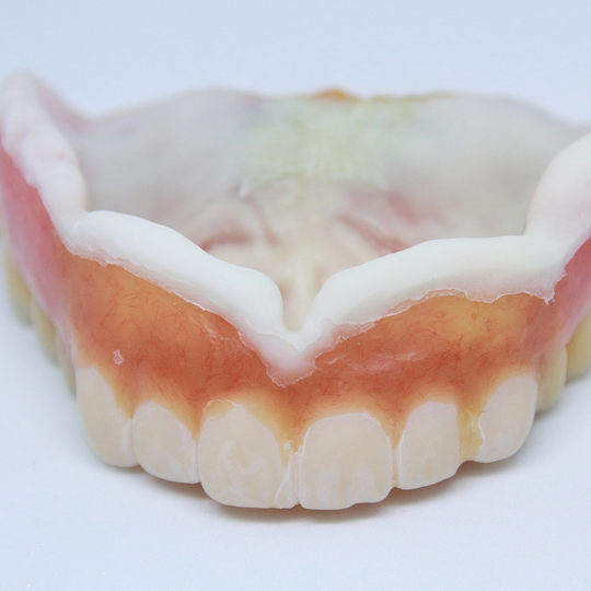 浜松市中区のセラミック治療