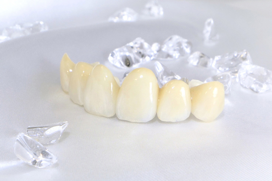 浜松市中区のセラミック治療