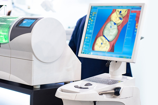 浜松市中区のセラミック治療