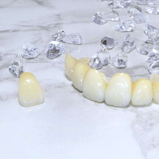 浜松市中区のセラミック治療